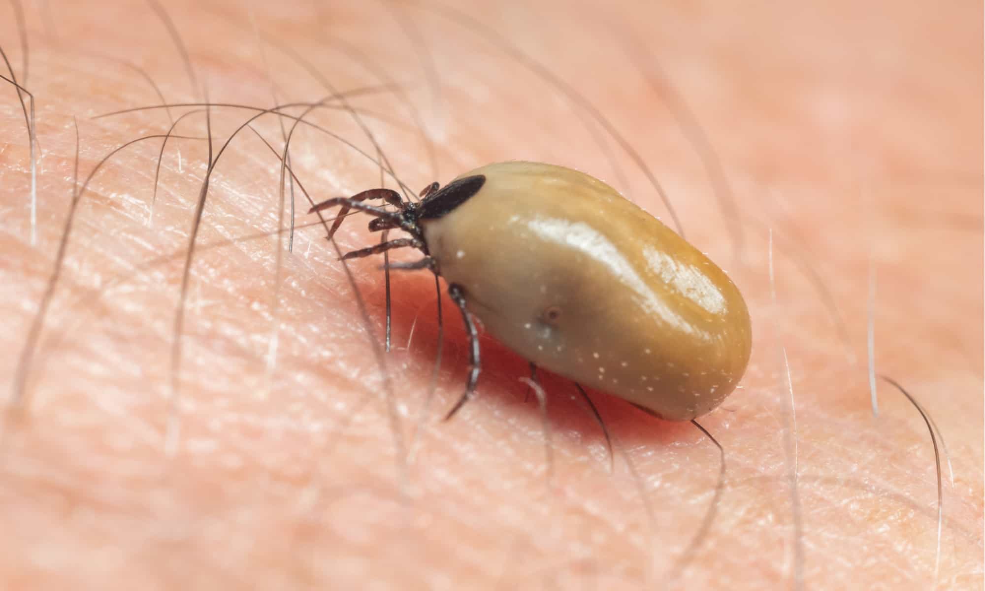 What Is The Difference Between Deer Ticks And Dog Ticks?